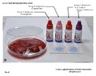 agglutination of streptococci